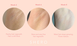Shero IPL Hair removal device result